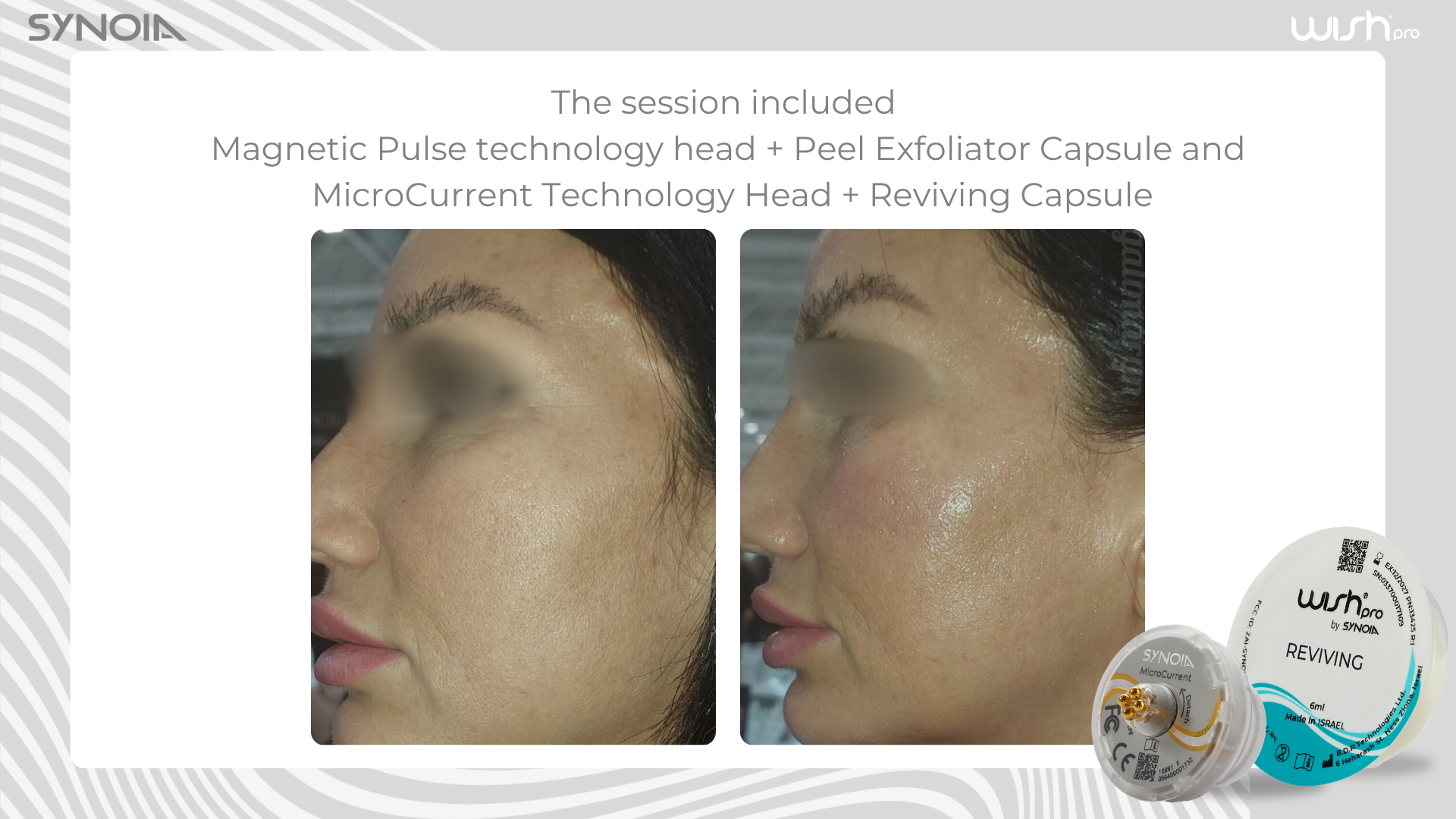 Before and after — Magnetic Pulse + Peel Exfoliator and MicroCurrent + Reviving Capsule
