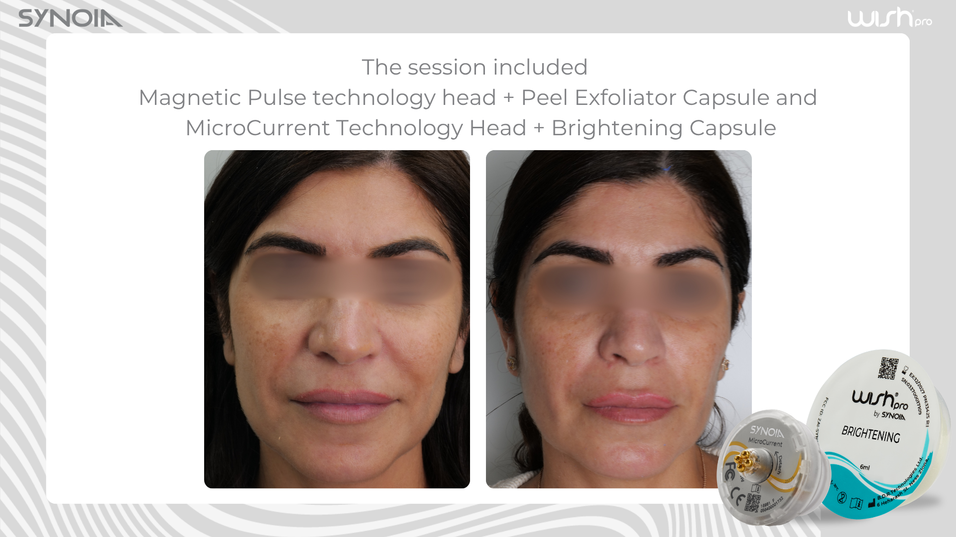 Before and after — Magnetic Pulse + Peel Exfoliator and MicroCurrent + Brightening Capsule