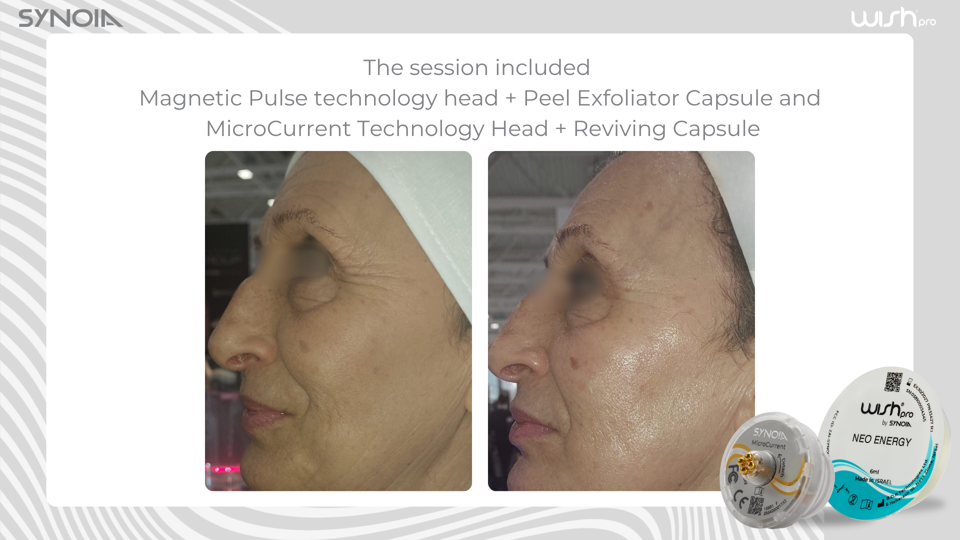 Before and after — Magnetic Pulse + Peel Exfoliator and MicroCurrent + Reviving Capsule