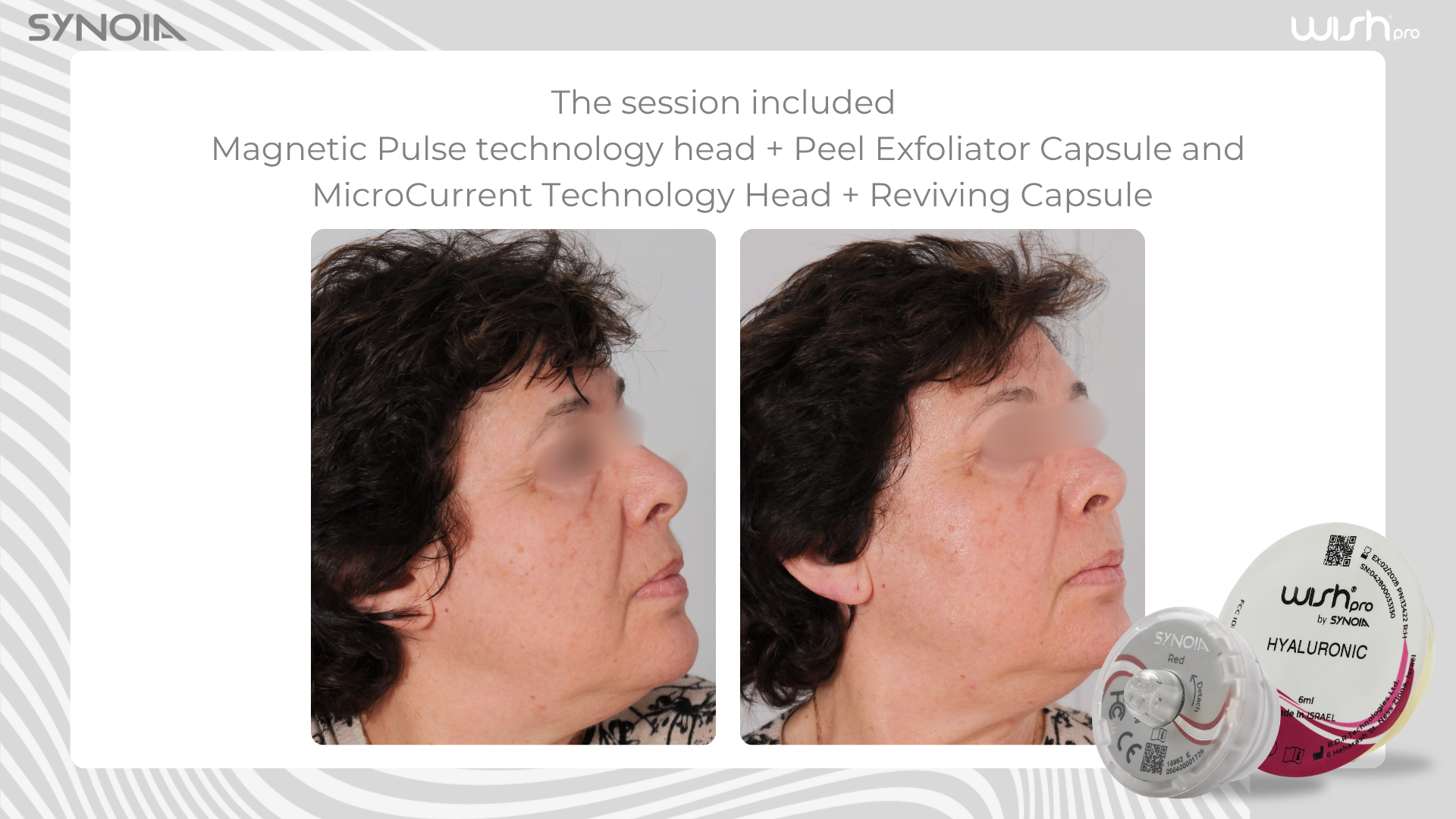 Before and after — Magnetic Pulse + Peel Exfoliator and MicroCurrent + Reviving Capsule