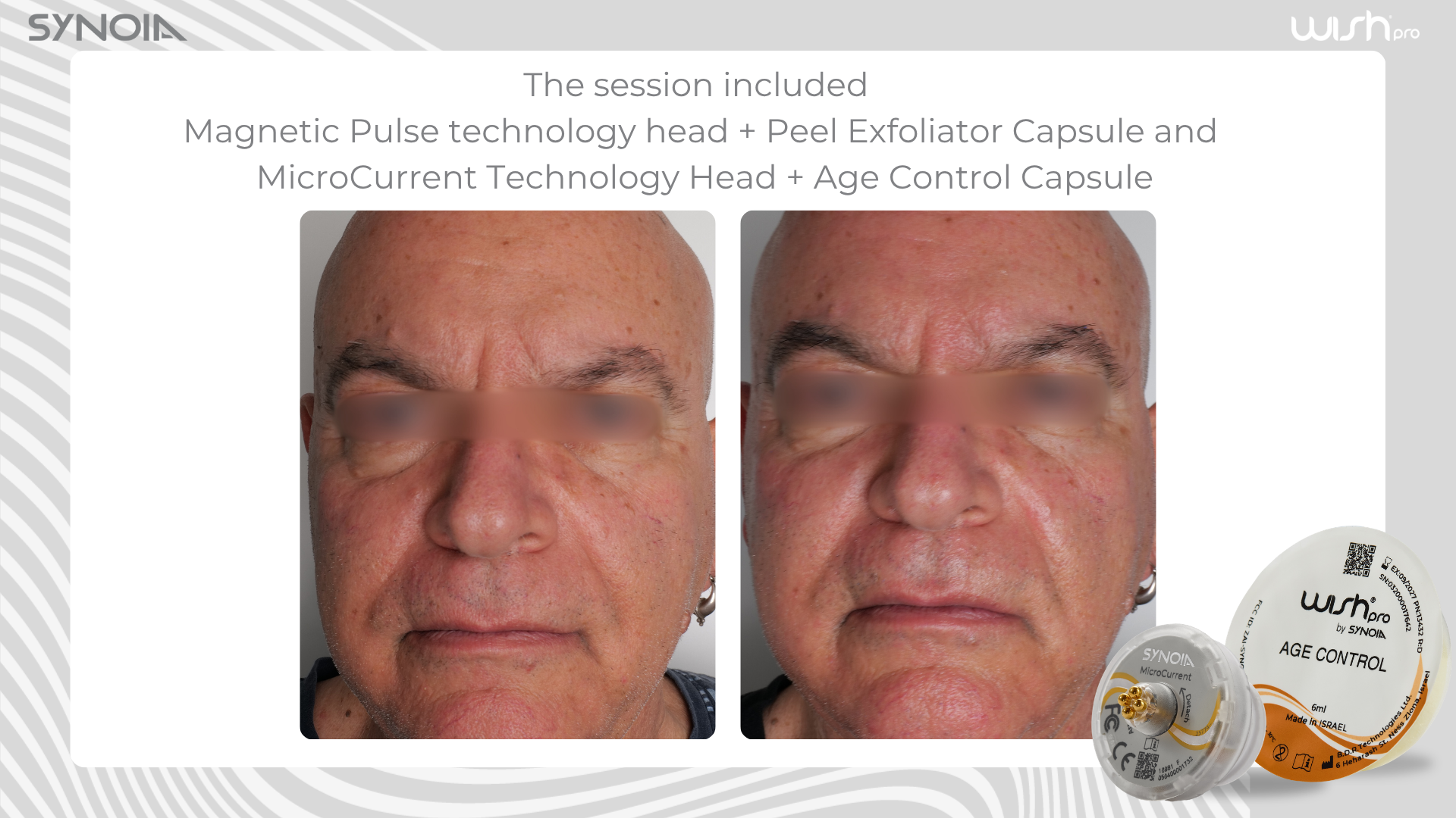 Before and after — Magnetic Pulse + Peel Exfoliator and MicroCurrent + Age Control Capsule
